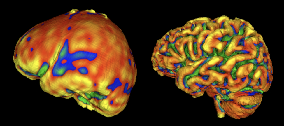 fMRI during non-linguistic sequence processing