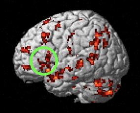 fMRI during non-linguistic sequence processing